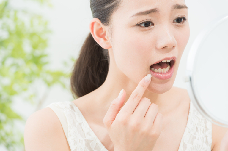 歯磨きしても虫歯になる原因
